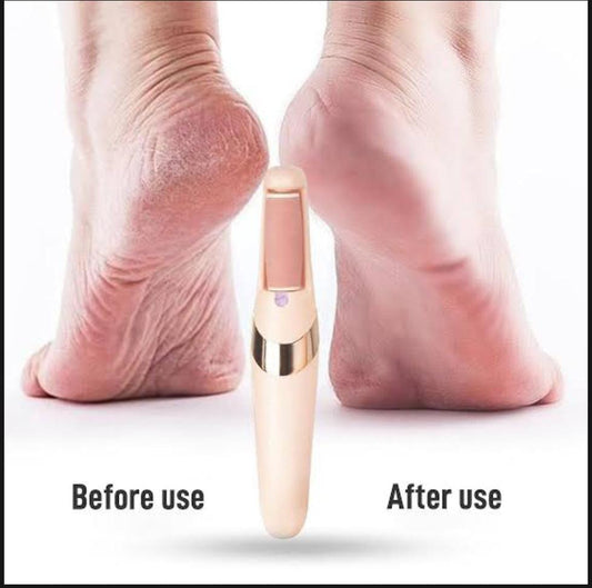 Rechargeable Electric Foot File – Remove Calluses Instantly SmoothFeet Pro™ – Electric Callus Remover Electric Foot File – Salon-Soft Feet at Home Callus Remover Pro – Rechargeable Foot Scrubber