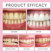 FORT Teeth Whitening Powder – 100% Natural Strong Formula fort teeth whitening powder